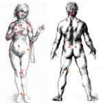 Fibromyalgie Tender Points mit Albrecht Dürer & Leonado da Vinci